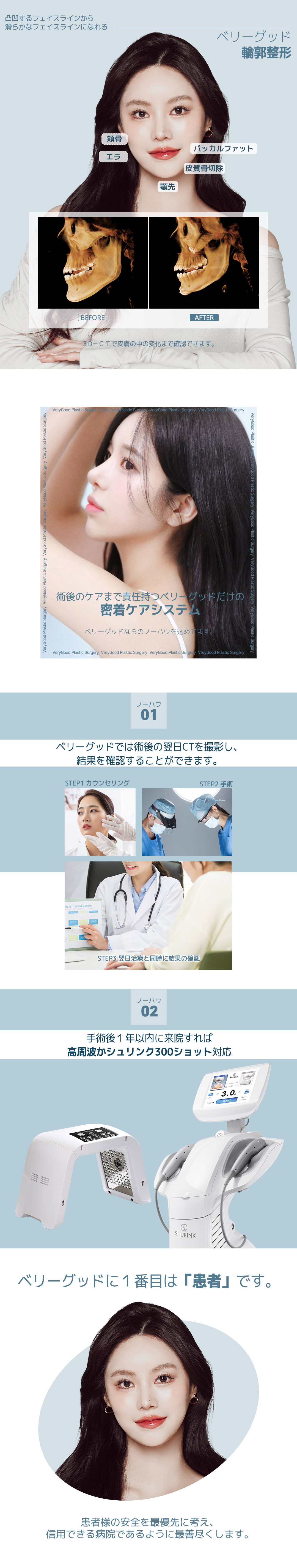 Bộ 3 điểm tạo hình đường viền CCTV (Gò má・Hàm・Cằm) Hệ thống theo dõi phẫu thuật an tâm｜Very Good Thẩm mỹ