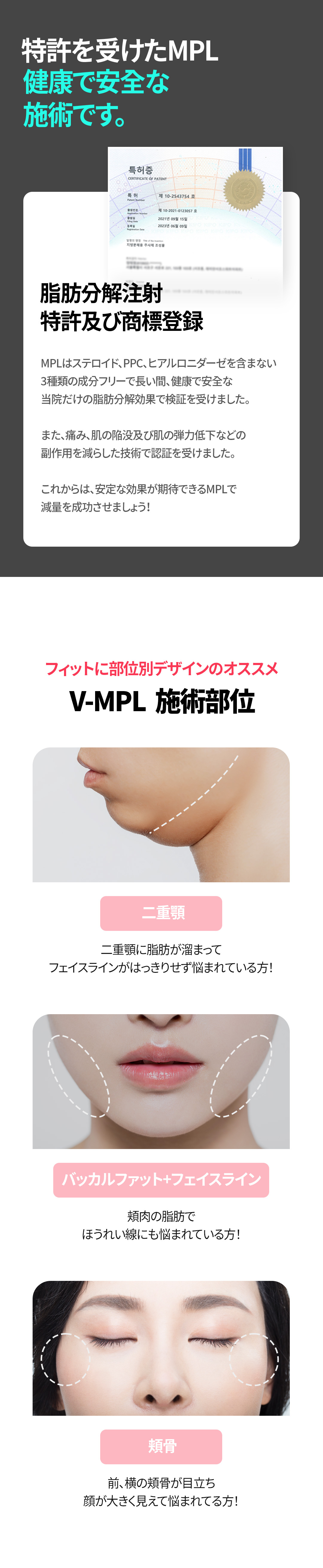 Tiêm tan mỡ mặt V-MPL hướng tới gương mặt nhỏ｜Tiêm tan mỡ có bằng sáng chế｜Seoul Sansang Clinic Sinsa