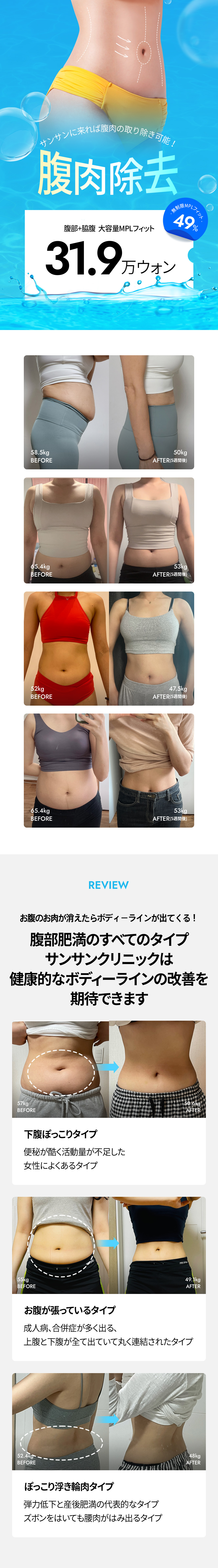 Tiêm tan mỡ MPL chăm sóc đường viền cơ thể vùng bụng và hông｜Seoul Sinsa stn.・Sansang Clinic Sinsa