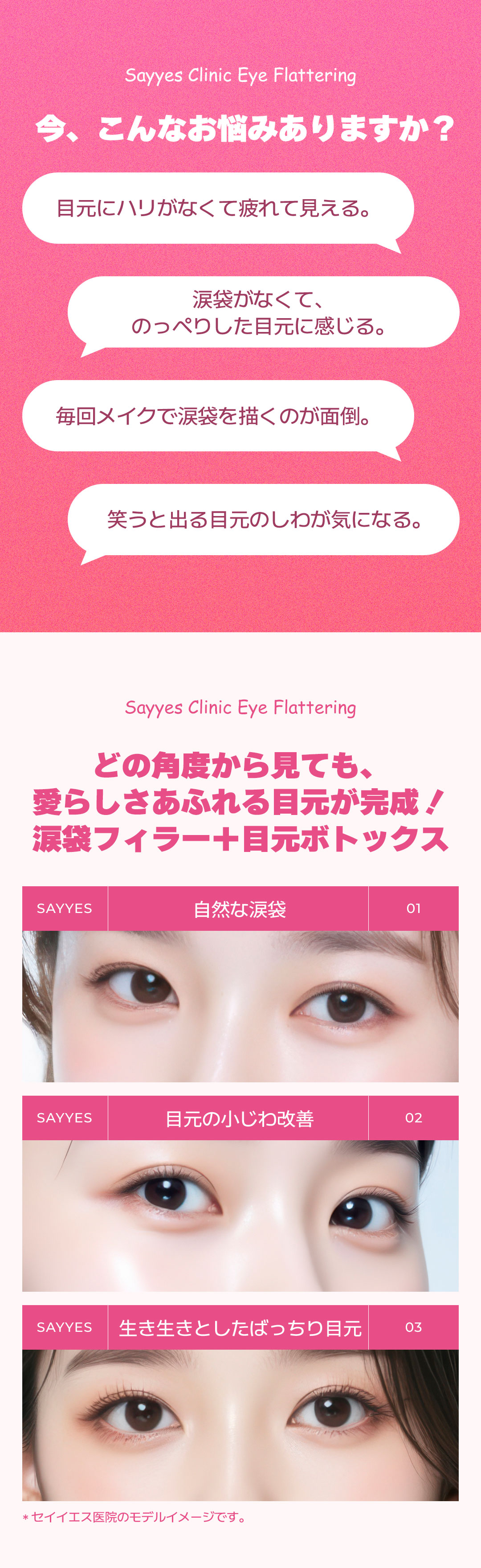 Bộ Lovely Eye kết hợp Filler túi lệ + Botox vùng mắt｜Thủ thuật hướng đến vùng mắt đáng yêu｜Phòng khám Say Yes Gangnam