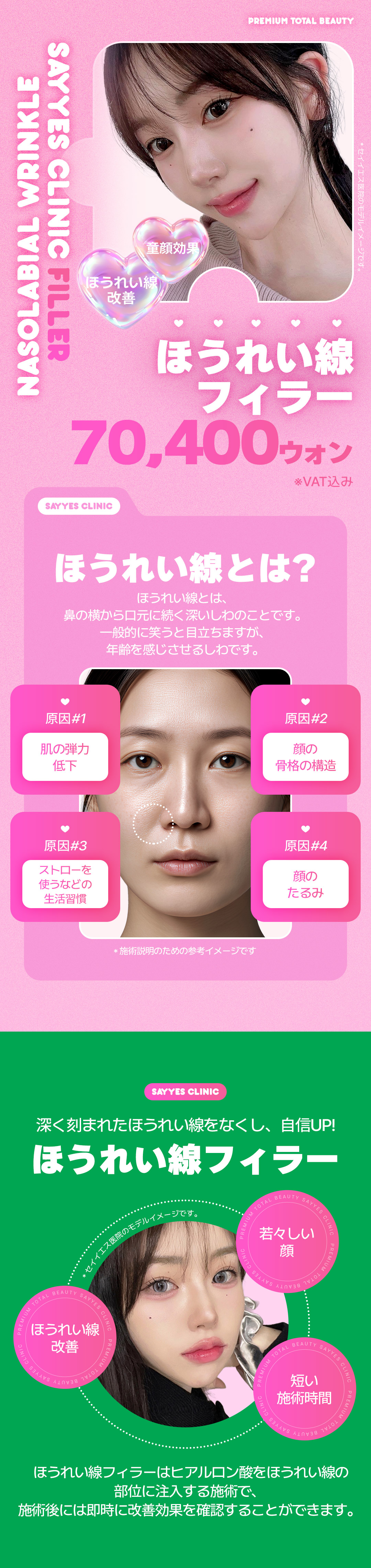 Thủ thuật filler rãnh mũi miệng Phòng khám Say Yes Seoul｜Hướng đến kết quả tự nhiên trong khoảng cách đi bộ từ ga Sinnonhyeon