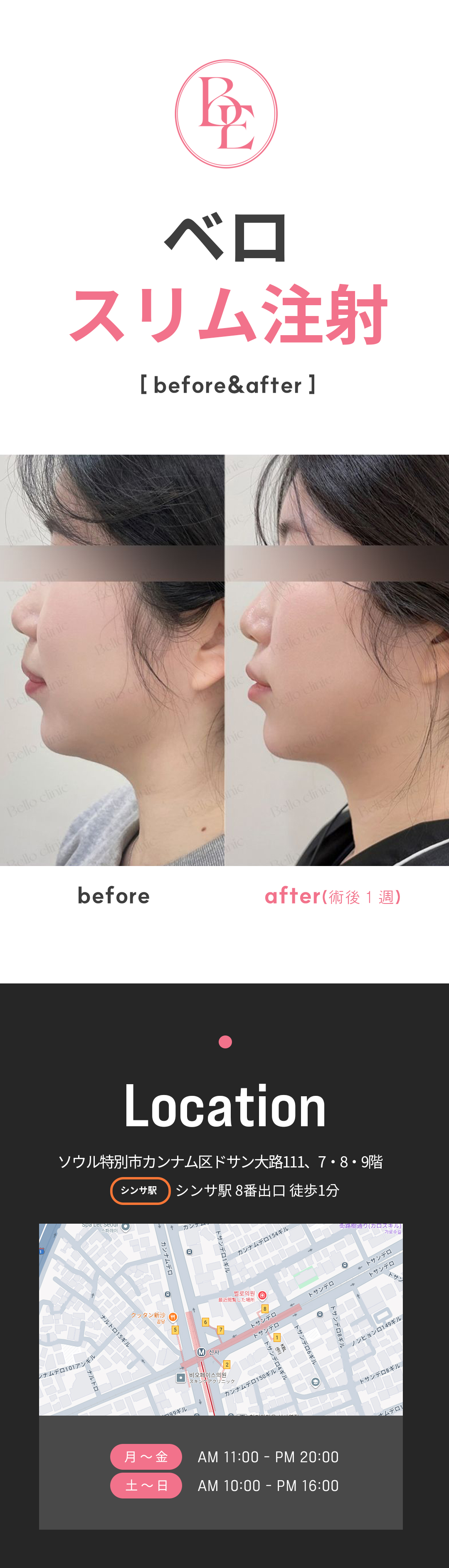 Tiêm Vero Slim hướng tới giảm mỡ từng phần | Tiêm tan mỡ ít thời gian nghỉ dưỡng | Seoul Sinsa stn.・Vero Clinic