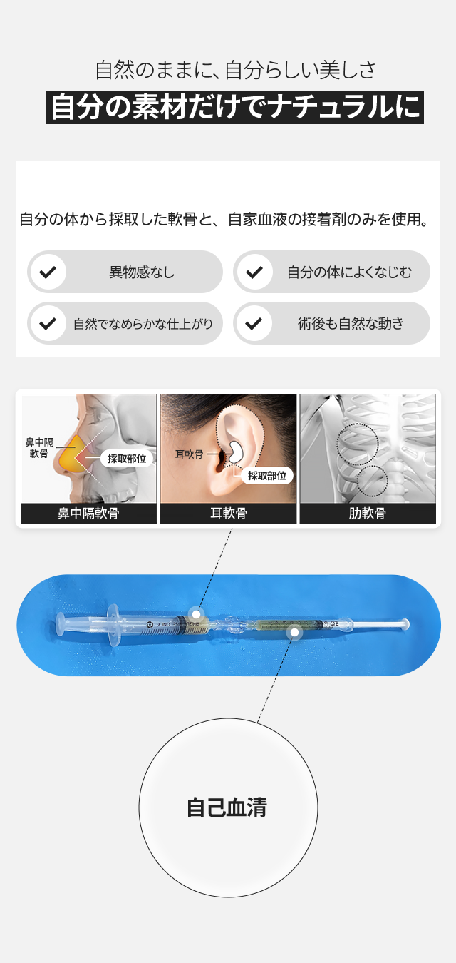 Tiêm Soft Nose | Nâng mũi tự nhiên bằng sụn tự thân・thời gian hồi phục 3 ngày | Seoul Gangnam Bệnh viện GNG