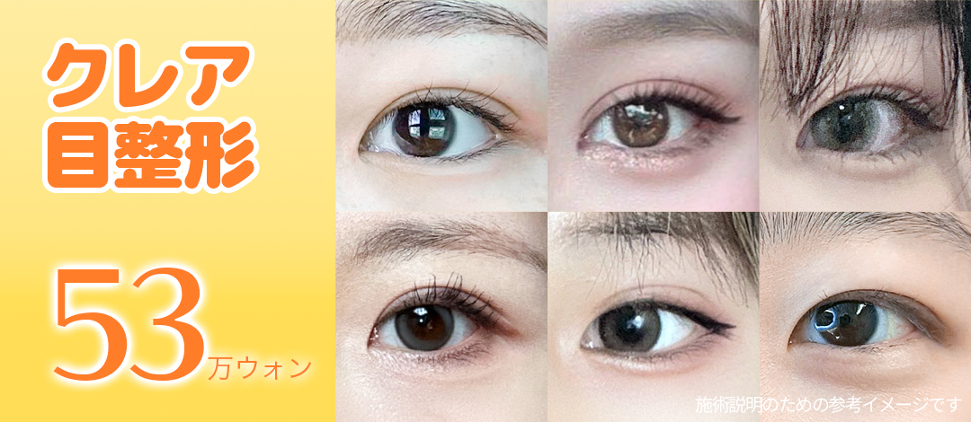 Chỉnh hình mí đôi・Chỉnh ánh mắt Hàn Quốc｜Chỉnh hình mắt đặt hàng từ 530.000 won｜Claire Thẩm mỹ (Trước ga Gangnam)