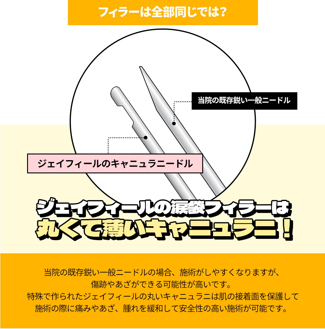Filler túi lệ hướng đến vùng mắt trẻ thơ tự nhiên｜Sử dụng kim cannula giảm đau｜Seoul Hongik Univ. stn.・Phòng khám Jfeel Hongdae