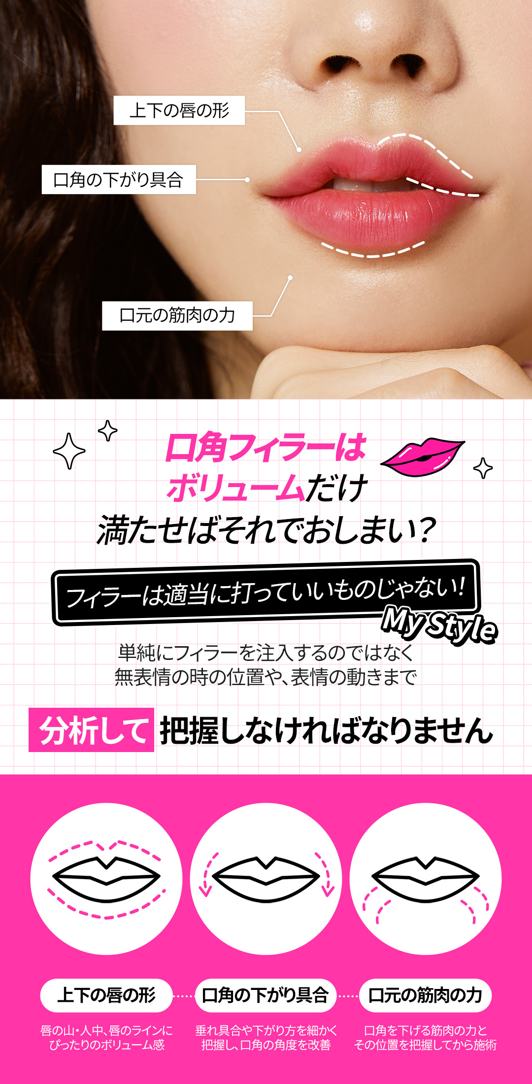 Filler khóe miệng & Botox hướng đến ấn tượng nụ cười tự nhiên｜Thủ thuật thiết kế chọn từ 3 loại｜Phòng khám Jfeel Hongdae