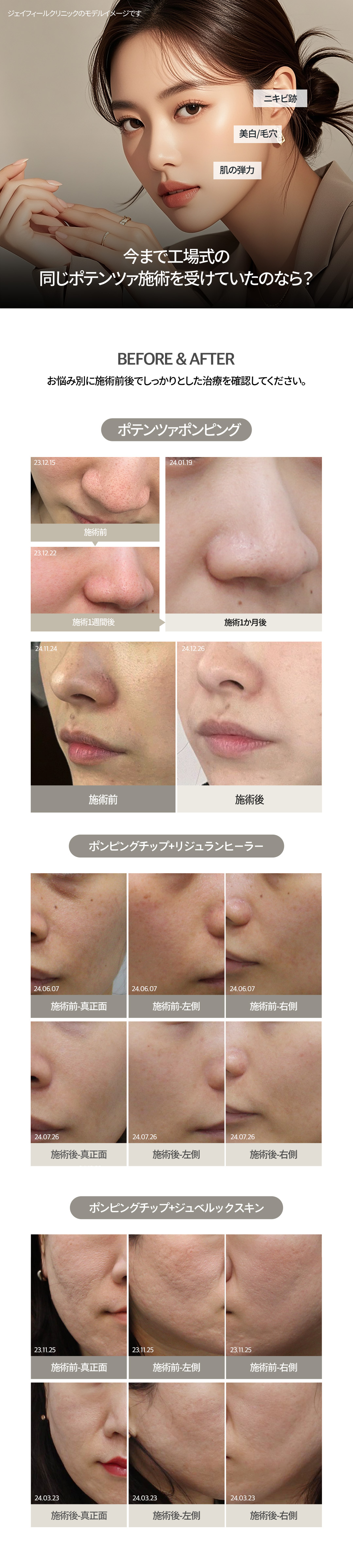 Làn da bóng rạng rỡ với Potenza