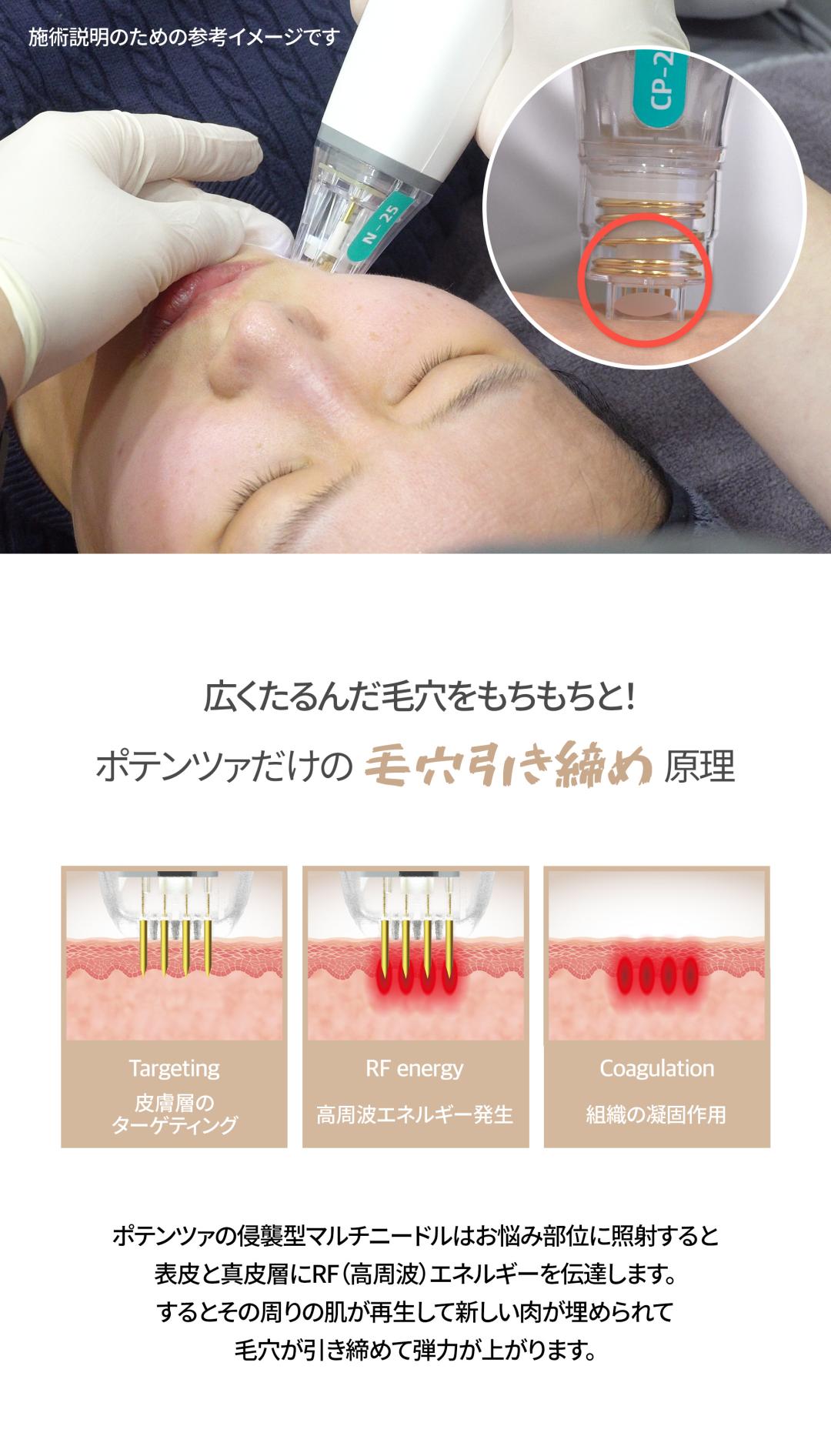 Làn da bóng rạng rỡ với Potenza