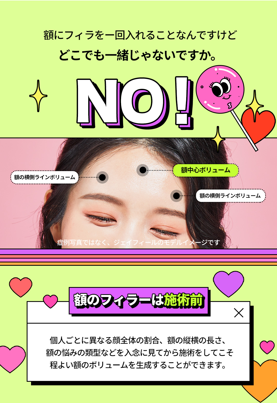 Thủ thuật filler trán 1cc hướng đến trán tròn căng mọng｜Phòng khám Jfeel Seoul Hongdae｜16.672 yên