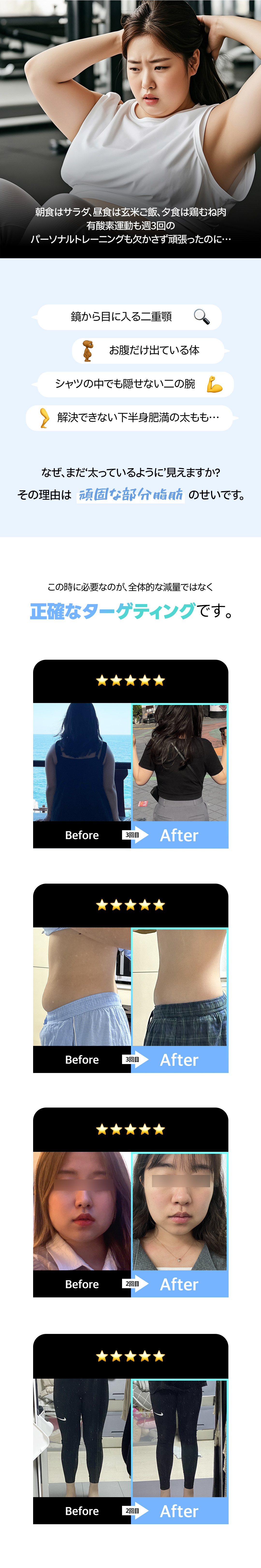 Tiêm tan mỡ Pettuse chăm sóc giảm mỡ cục bộ｜Mặt・bắp tay・đùi｜Jfeel Clinic Hongdae 17,863 yên