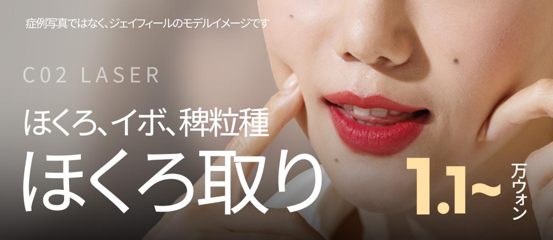 Xóa nốt ruồi・mụn cóc bằng CO2 Laser | Hướng dẫn phương pháp của Phòng khám Jfeel Hàn Quốc Hongdae