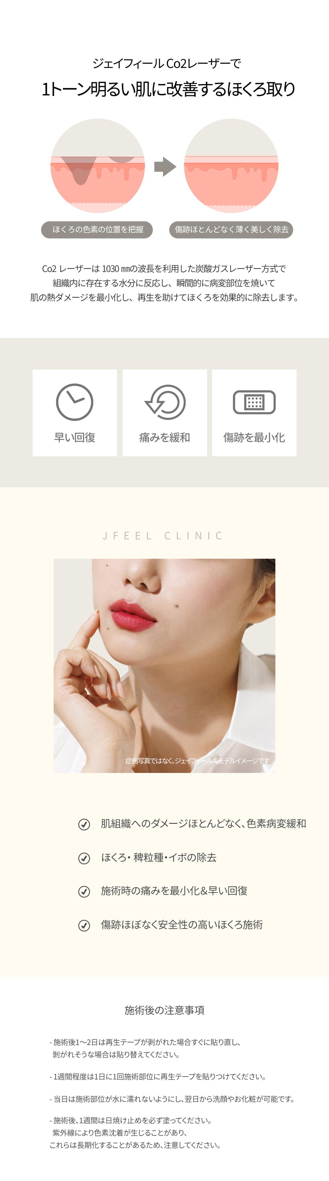 Xóa nốt ruồi・mụn cóc bằng CO2 Laser | Hướng dẫn phương pháp của Phòng khám Jfeel Hàn Quốc Hongdae