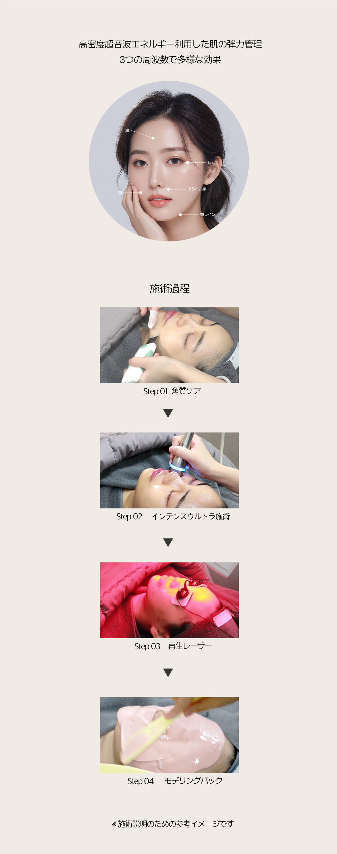 Intense Ultra｜Chăm sóc độ săn chắc và đàn hồi bằng siêu âm mật độ cao từ Đức｜Phòng khám Jfeel Hongdae