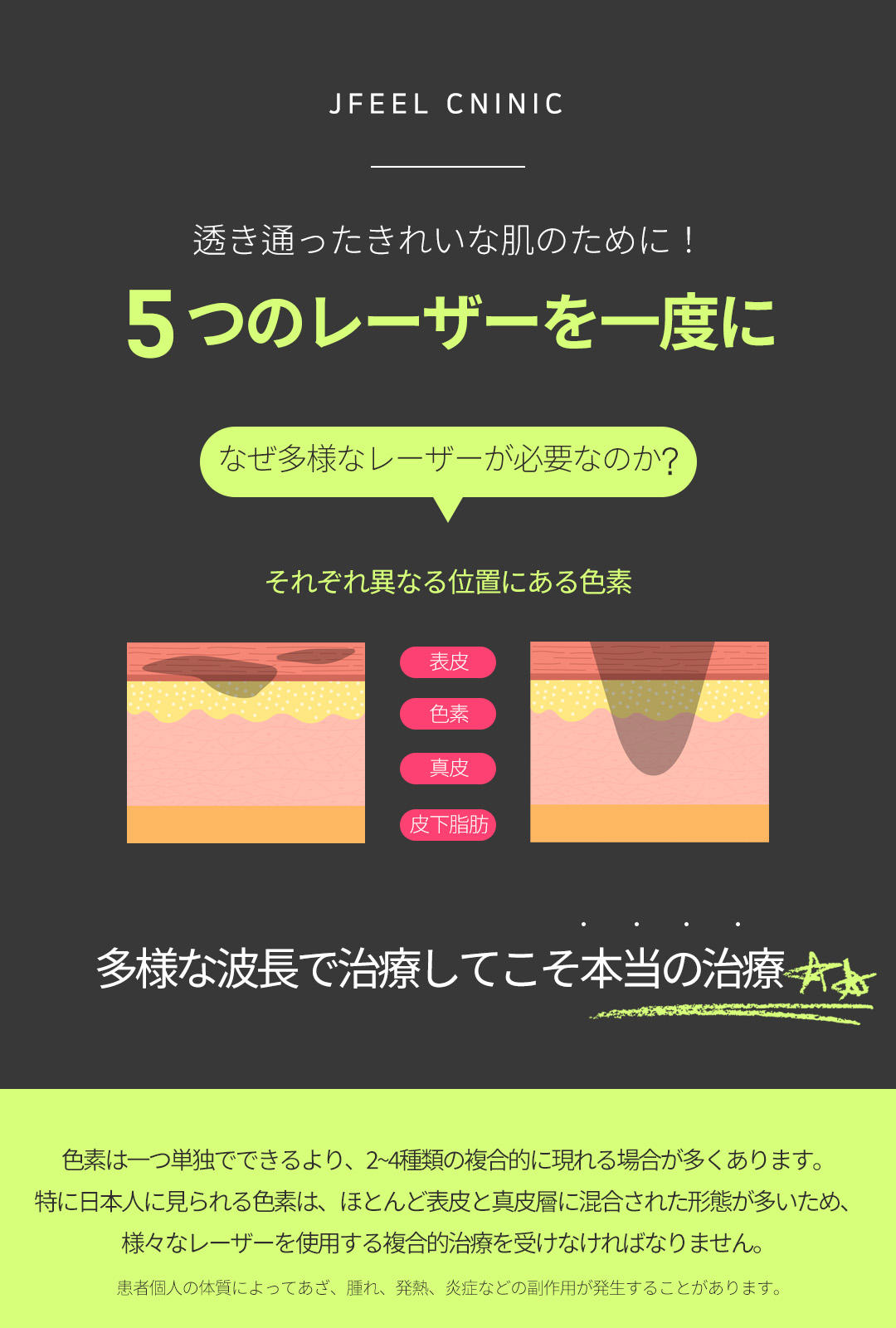 Phương pháp chăm sóc sắc tố kết hợp nhiều loại laser | Dành cho những ai lo lắng về nám・sẹo mụn・sắc tố