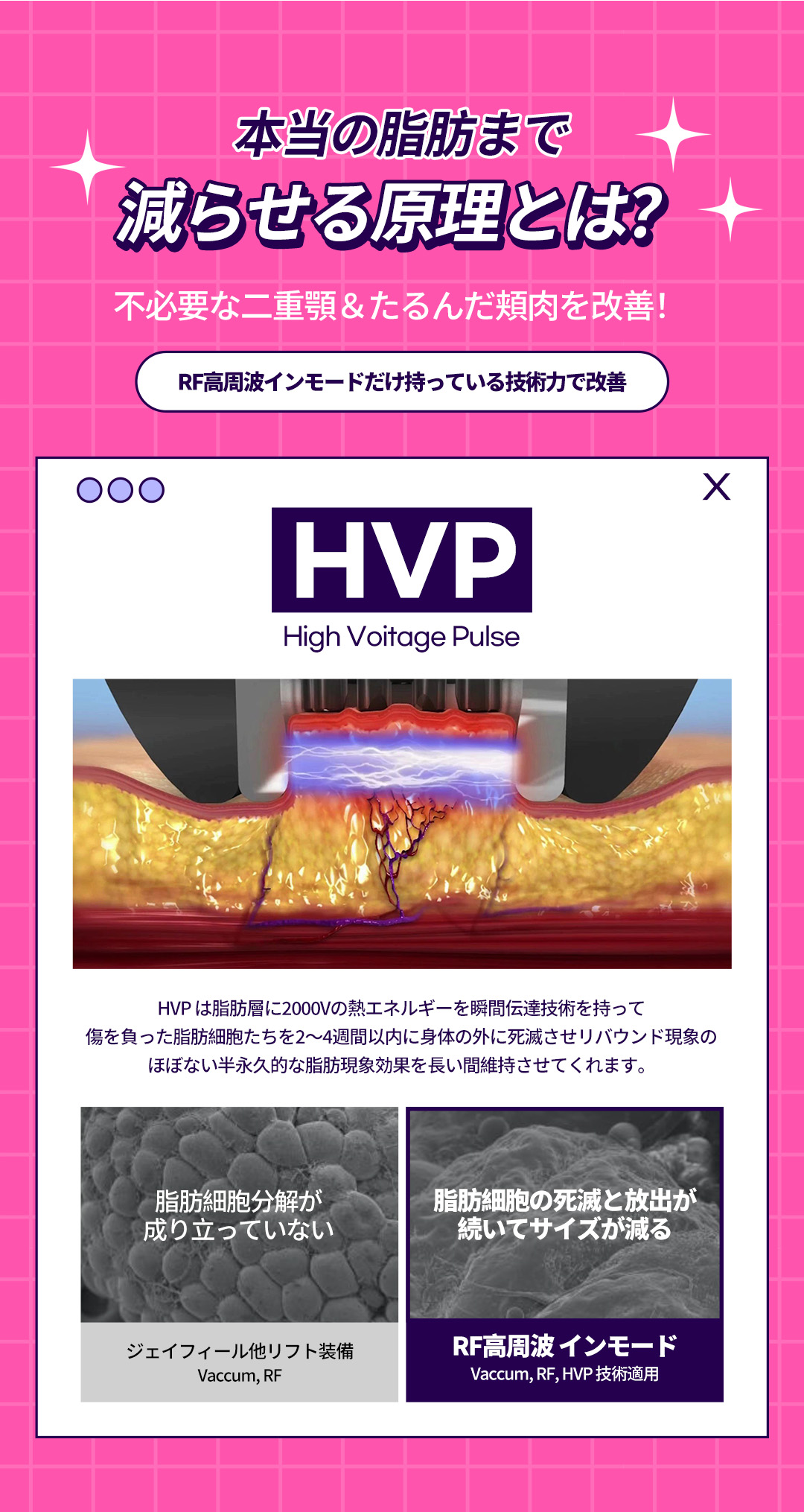 InMode RF cao tần | Giảm mỡ + nâng cơ cải thiện V-line | J Feel Gangnam