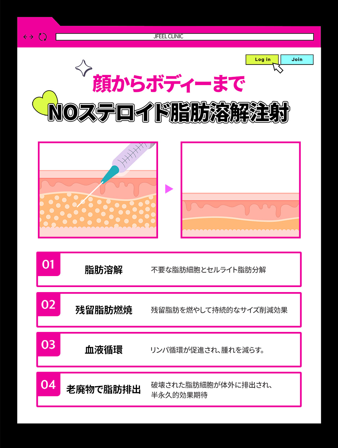 Tiêm tan mỡ & Body HIFU từ 6,550 yên | Hỗ trợ giảm mỡ cục bộ với công thức NO steroid | Jfeel Clinic Hongdae