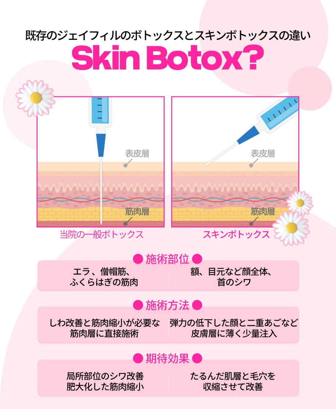 Skin Botox Phòng khám Jfeel Hongdae｜Thủ thuật da đẹp hướng đến cải thiện độ căng da trán・vùng mắt【Từ 7.145 yên】