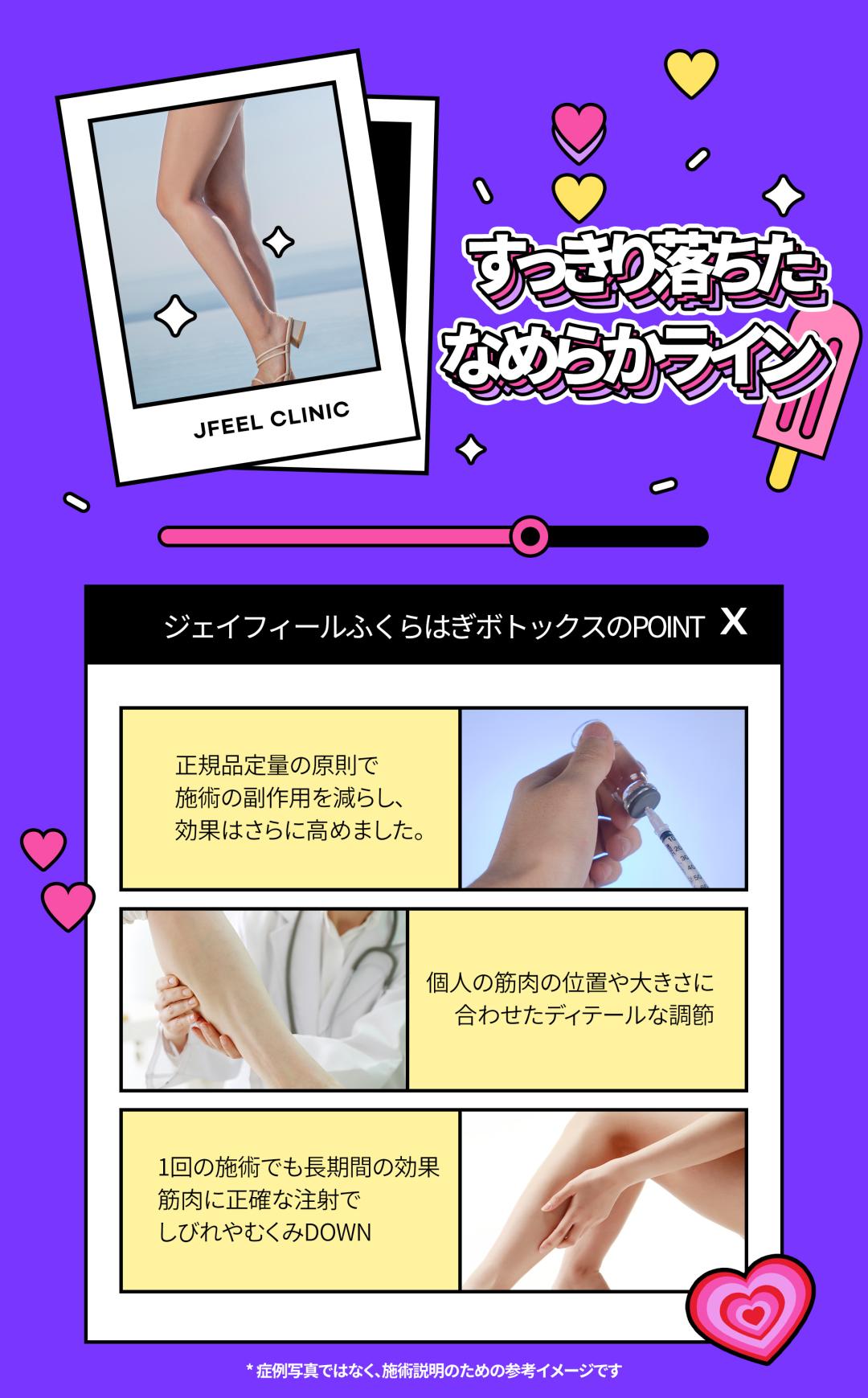 Thủ thuật Body Botox｜Hướng đến cải thiện bắp chân・vai・mồ hôi nhiều｜Phòng khám Jfeel Seoul Gangnam