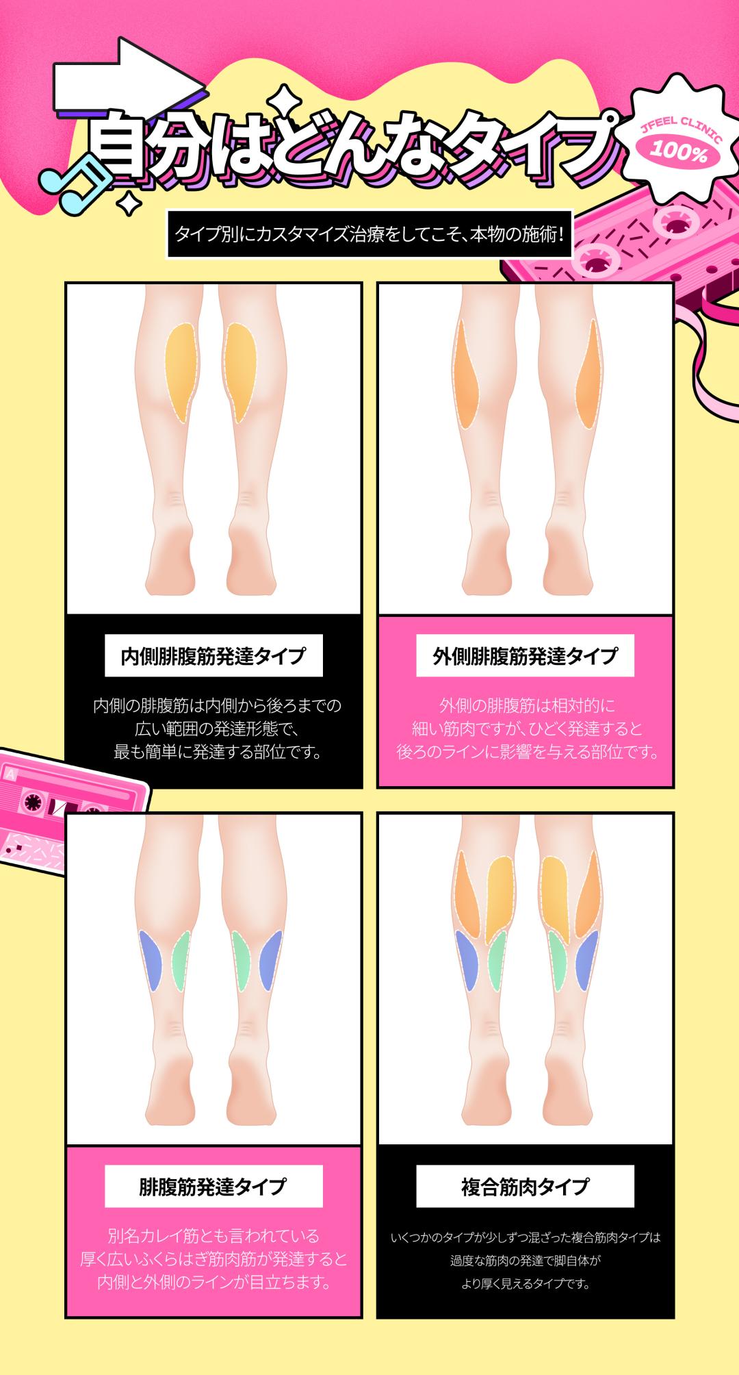 Thủ thuật Body Botox｜Hướng đến cải thiện bắp chân・vai・mồ hôi nhiều｜Phòng khám Jfeel Seoul Gangnam