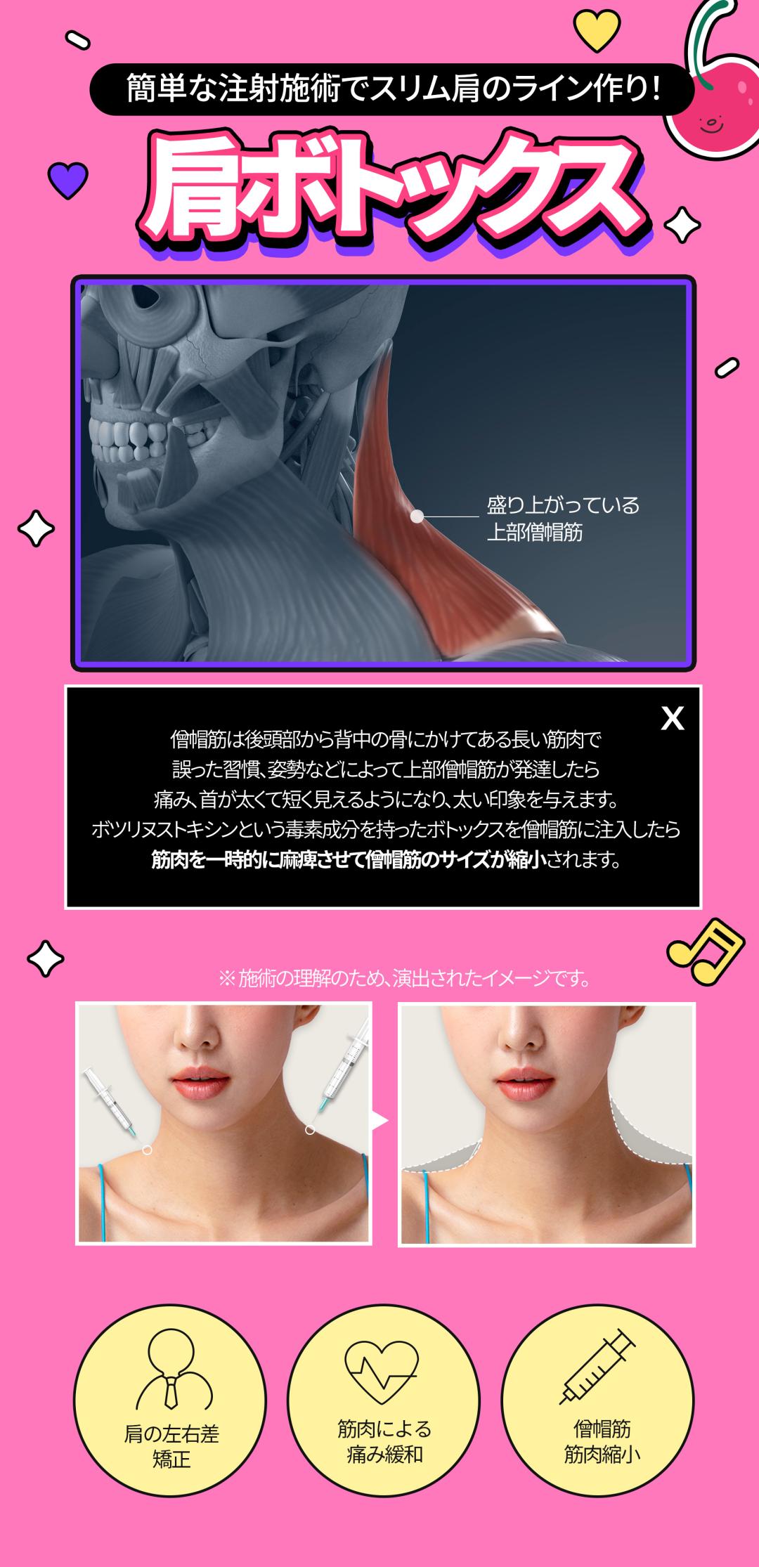 Thủ thuật Body Botox｜Hướng đến cải thiện bắp chân・vai・mồ hôi nhiều｜Phòng khám Jfeel Seoul Gangnam