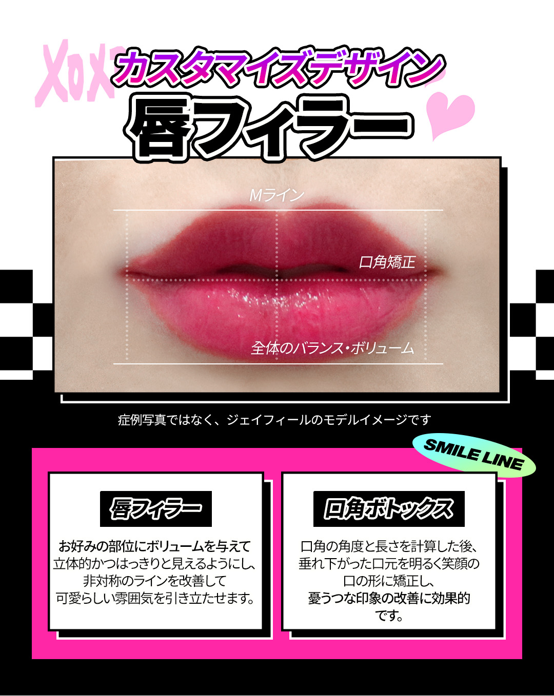 【Phòng khám Jfeel Hongdae】Filler Hyaluronic Acid môi・mũi・trán｜Thủ thuật thẩm mỹ Hàn Quốc hướng đến độ nổi tự nhiên với tùy chỉnh theo vùng