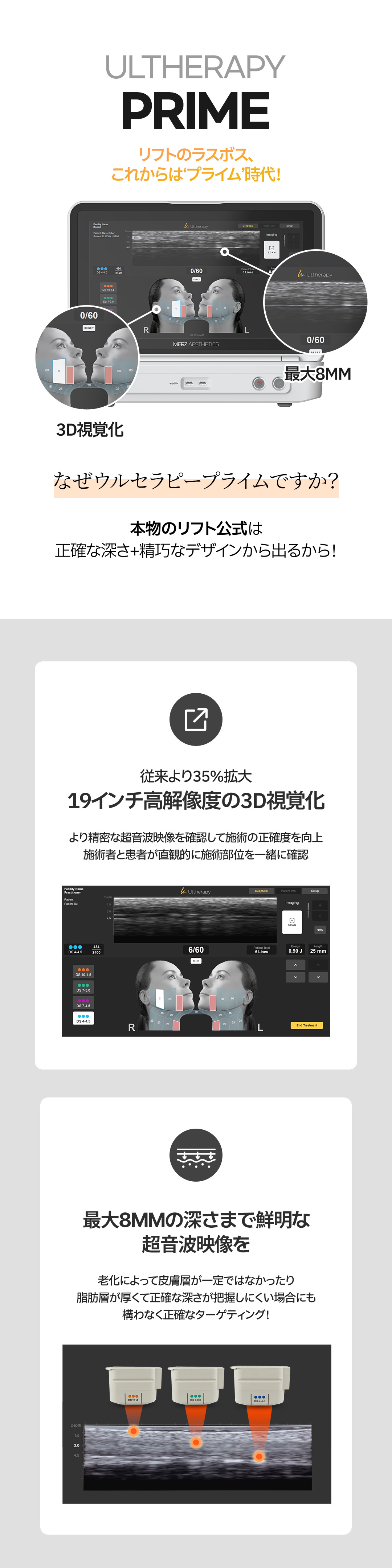 Ultherapy Prime｜Nâng cơ chính xác với trực quan hóa 3D｜Viện Jfeel Hongdae【Viện được chứng nhận chính thức】