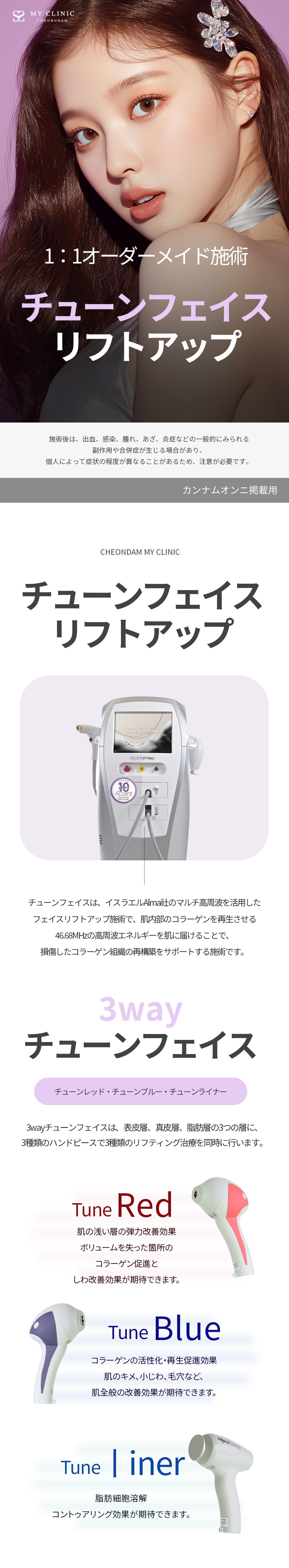 Tune Face Lifting | Chăm sóc độ đàn hồi da và chảy xệ bằng sóng cao tần Israel | Phòng khám Cheongdam My Seoul Gangnam