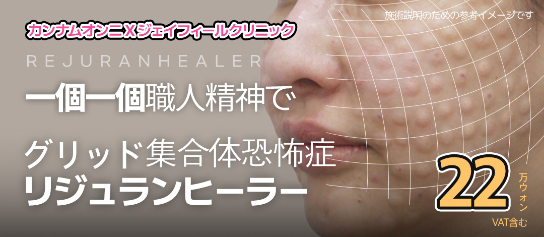 Rejuran Healer | Liệu trình Skin Booster chứa thành phần PN có nguồn gốc từ cá hồi