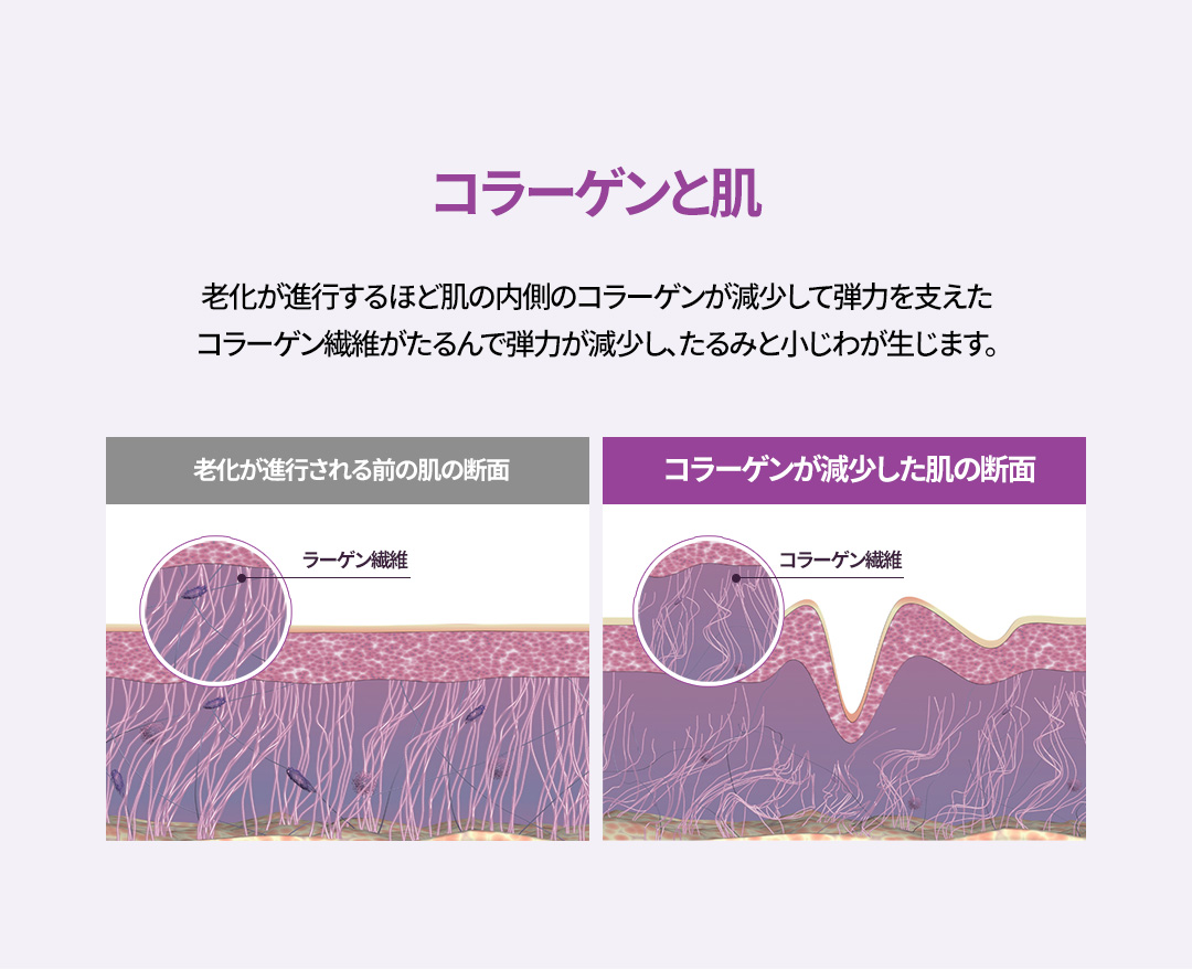 Thermage FLX｜Nhắm đến nâng và cải thiện chảy xệ bằng tái tạo collagen｜Phòng khám Jfeel chi nhánh Hongdae