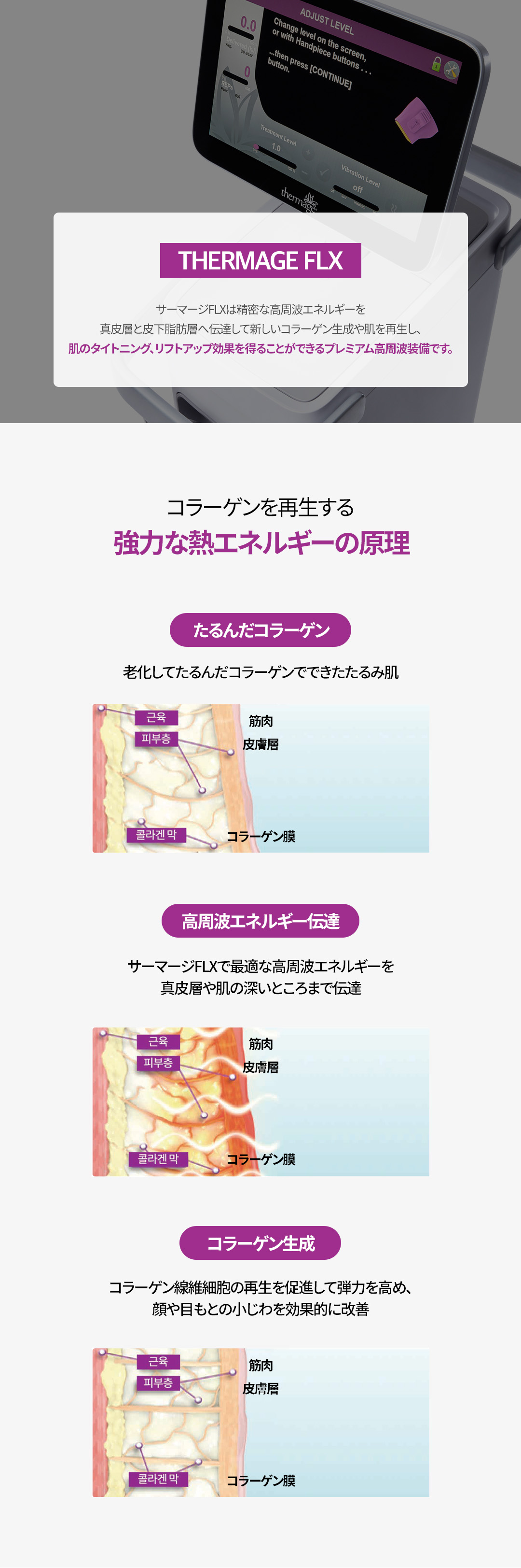 Thermage FLX｜Nhắm đến nâng và cải thiện chảy xệ bằng tái tạo collagen｜Phòng khám Jfeel chi nhánh Hongdae