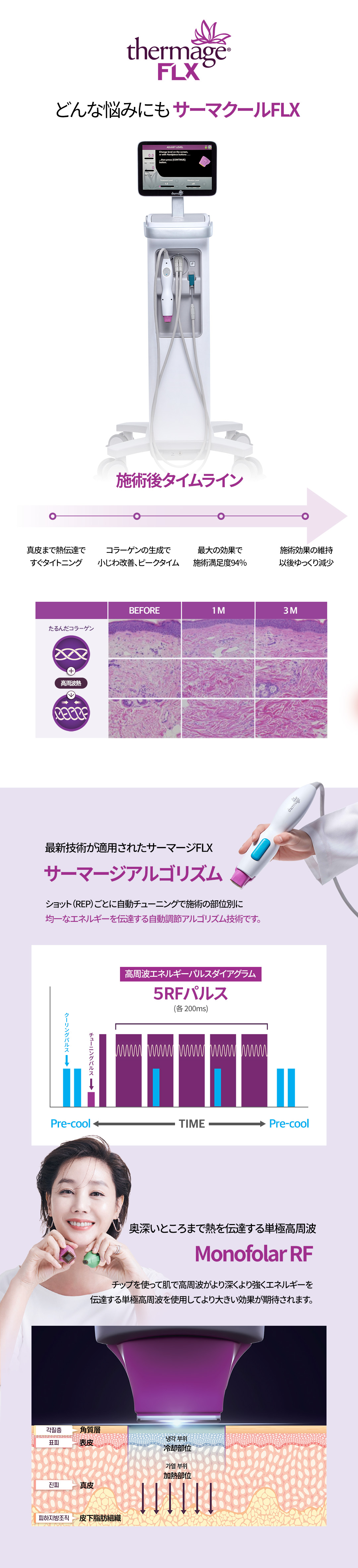 Thermage FLX｜Nhắm đến nâng và cải thiện chảy xệ bằng tái tạo collagen｜Phòng khám Jfeel chi nhánh Hongdae