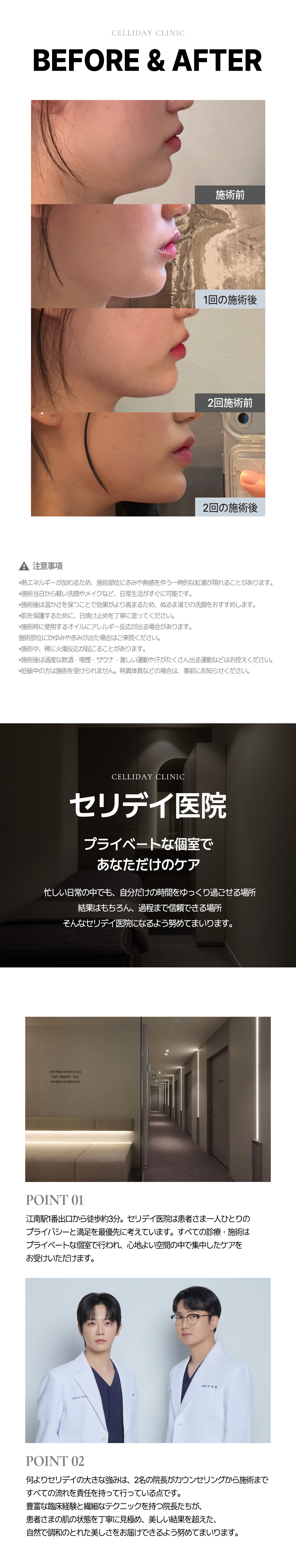 Onda Lift | Liệu trình hướng đến cải thiện chảy xệ và nâng bằng sóng vi ba | Seriday Clinic Myeongdong