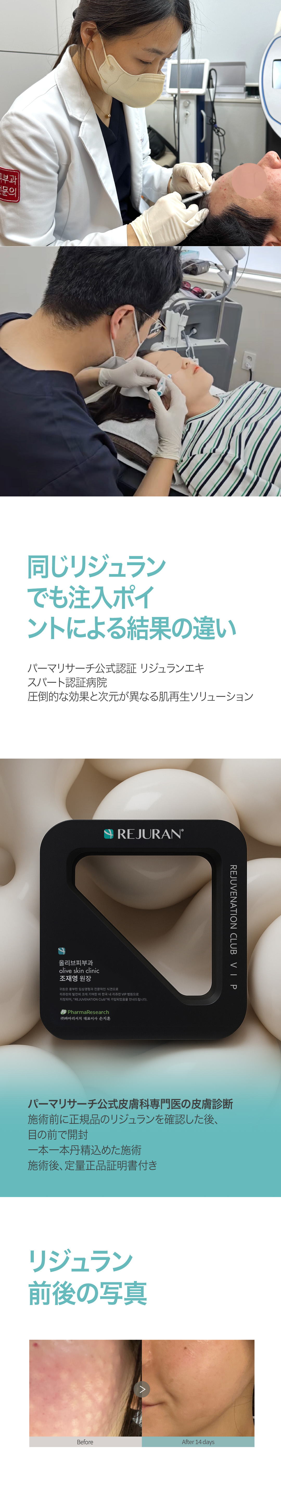 Tiêm Rejuran | Chăm sóc tái tạo da và căng da bởi bác sĩ chuyên khoa da liễu【Sử dụng sản phẩm chính hãng】