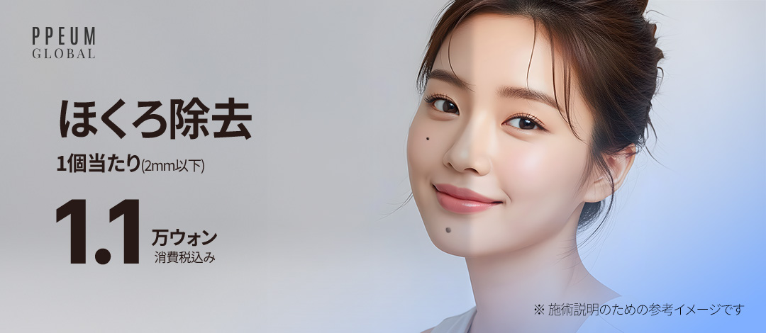 Tẩy nốt ruồi tại Myeong-dong Hàn Quốc | Điều trị laser từ khoảng 1.191 yên cho 1 nốt dưới 2mm