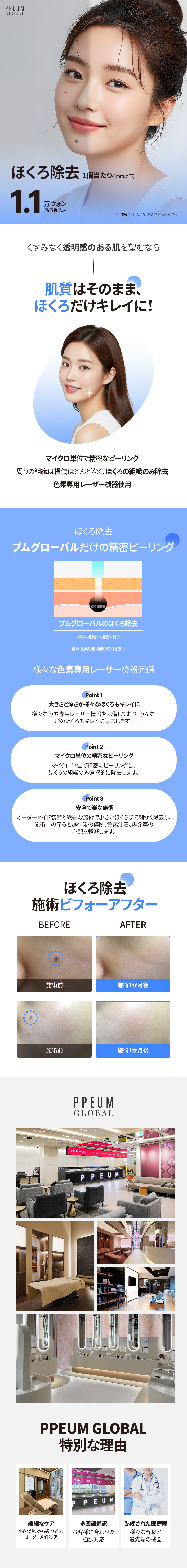 Tẩy nốt ruồi tại Myeong-dong Hàn Quốc | Điều trị laser từ khoảng 1.191 yên cho 1 nốt dưới 2mm