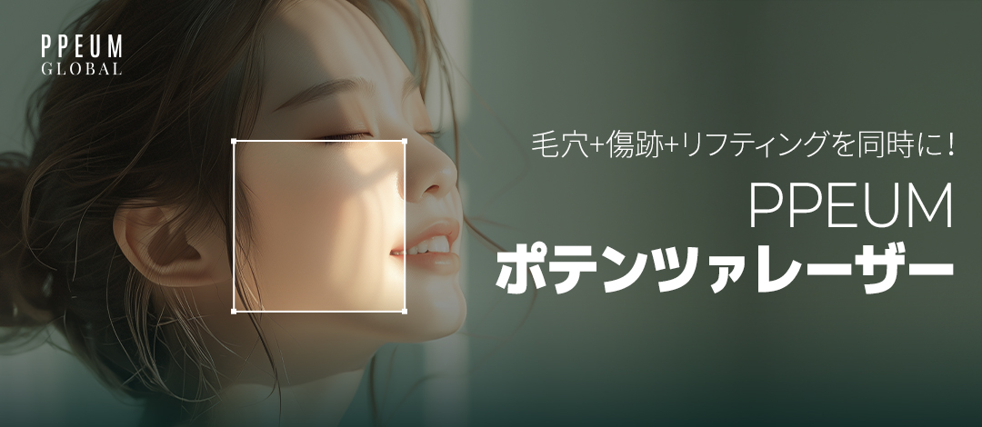 Potenza Laser PPEUM | Kim siêu nhỏ × RF sóng cao tần chăm sóc lỗ chân lông, sẹo, nâng cơ