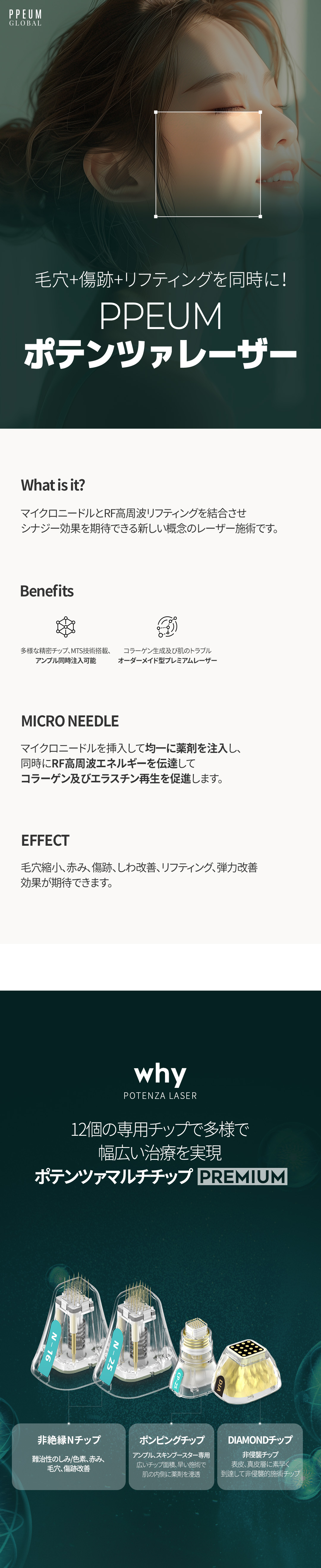 Potenza Laser PPEUM | Kim siêu nhỏ × RF sóng cao tần chăm sóc lỗ chân lông, sẹo, nâng cơ