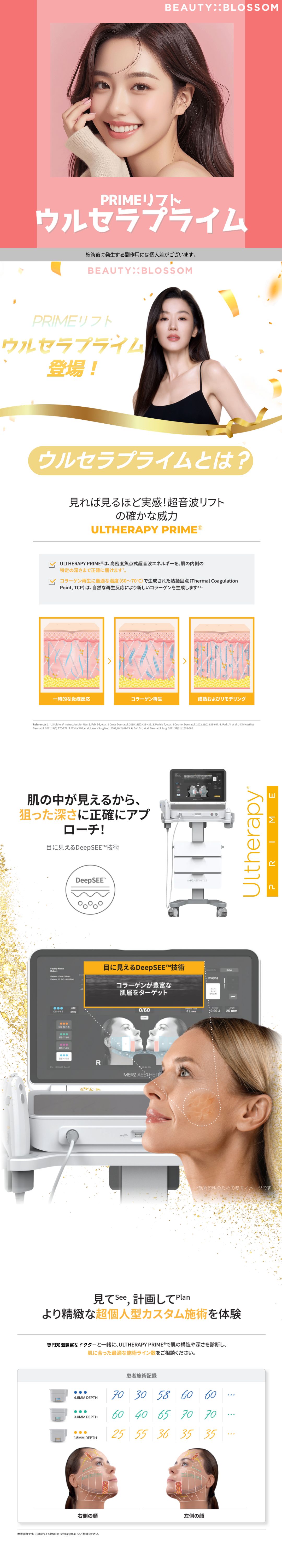 Ultherapy Prime | Chăm sóc độ đàn hồi và chảy xệ bằng nâng cơ siêu âm | Beauty Blossom Phòng khám Seoul Hongdae