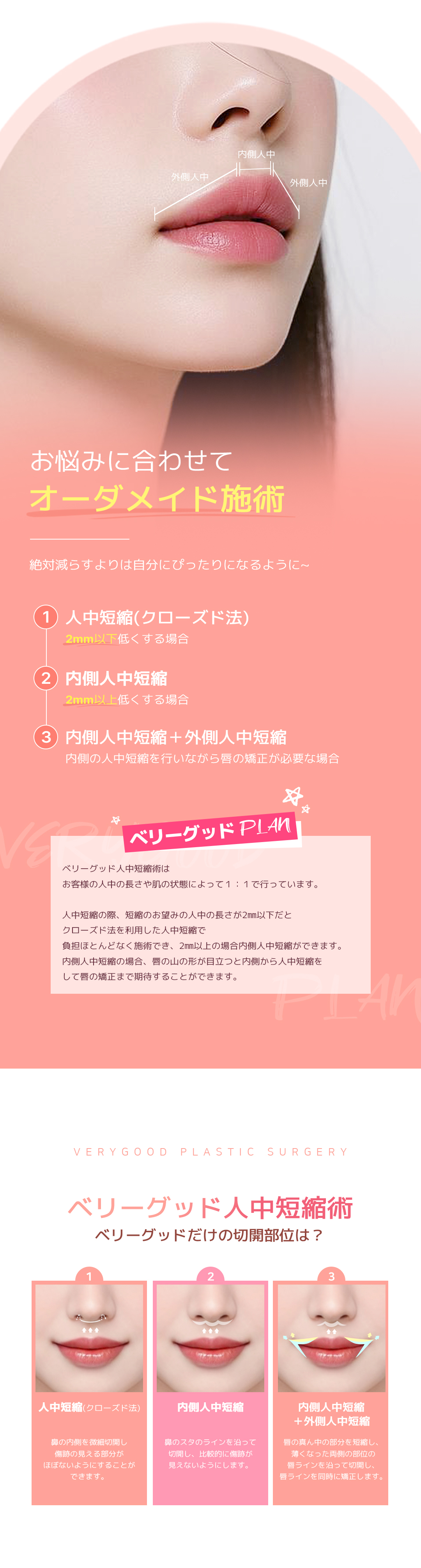 Hướng đến cải thiện cân bằng giữa mặt với phẫu thuật rút ngắn nhân trung | Liệu pháp tùy chỉnh hỗ trợ phương pháp đóng