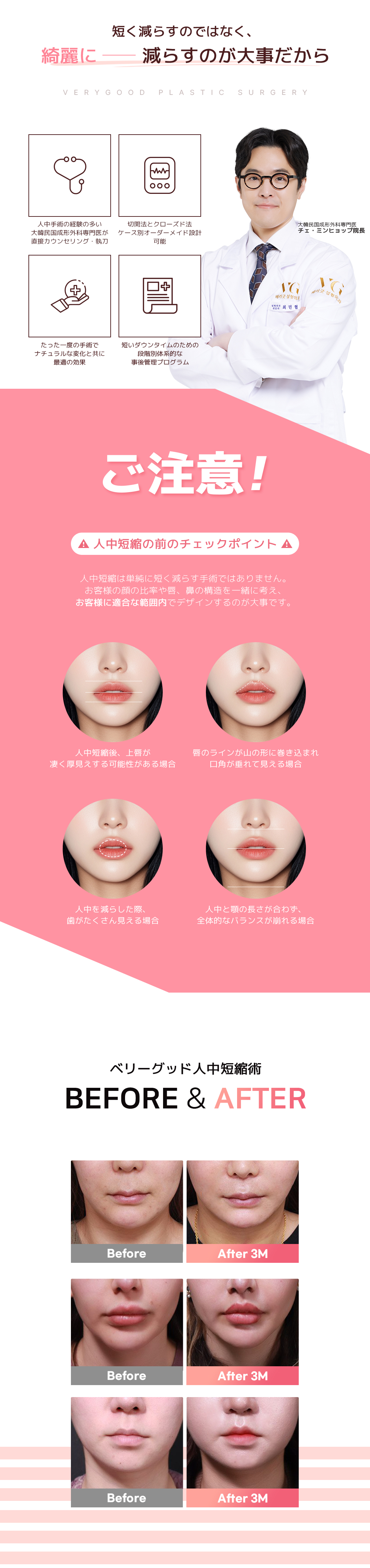 Hướng đến cải thiện cân bằng giữa mặt với phẫu thuật rút ngắn nhân trung | Liệu pháp tùy chỉnh hỗ trợ phương pháp đóng