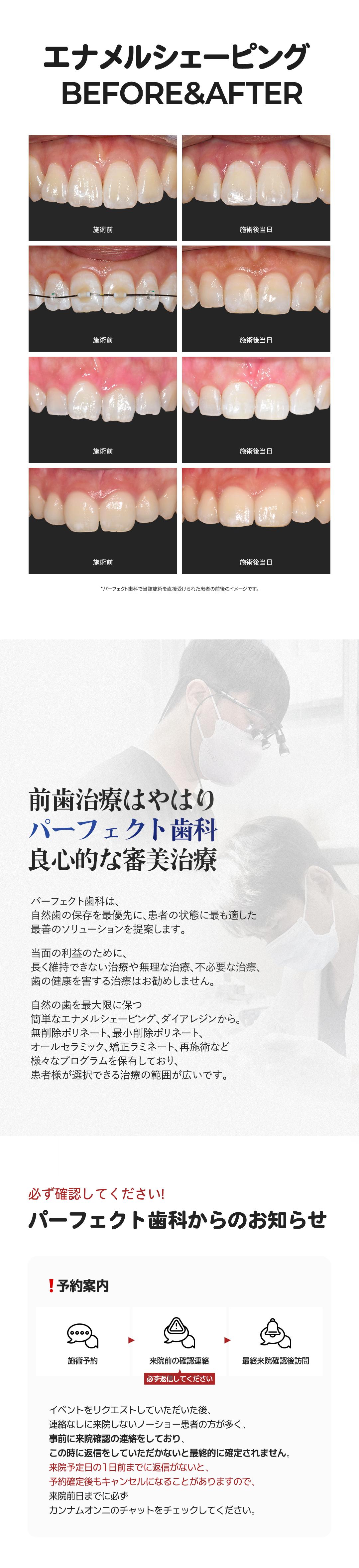 1DAY Enamel Shaping | Hướng tới cải thiện hình dạng răng trong khoảng 30 phút | Không cần gây tê | Ga Gangnam Perfect Dental