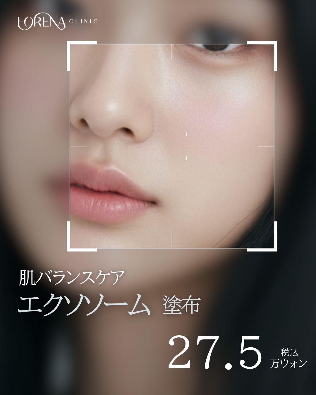 Chăm sóc cao cấp bôi Exosome｜Tái tạo da độ tinh khiết cao 5 tỷ hạt｜Viện Forena Hongdae