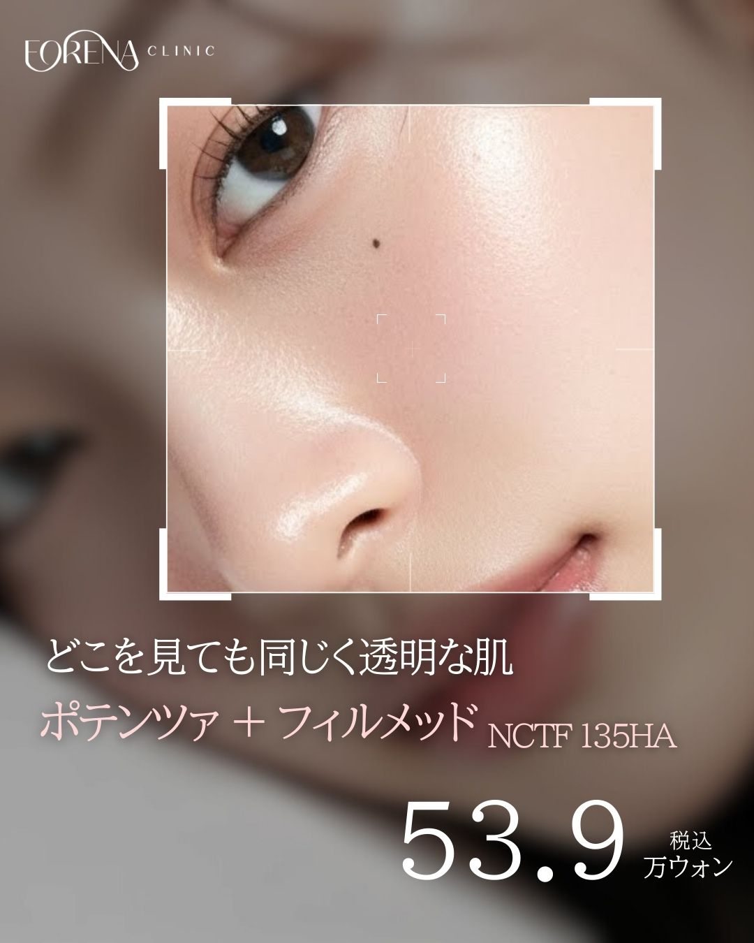 Potenza × Filorga NCTF135HA | Gói Premium Booster hướng tới tái tạo da