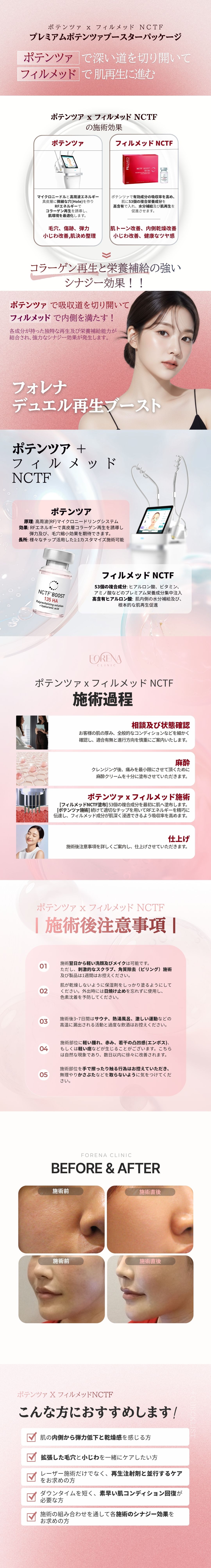 Potenza × Filorga NCTF135HA | Gói Premium Booster hướng tới tái tạo da