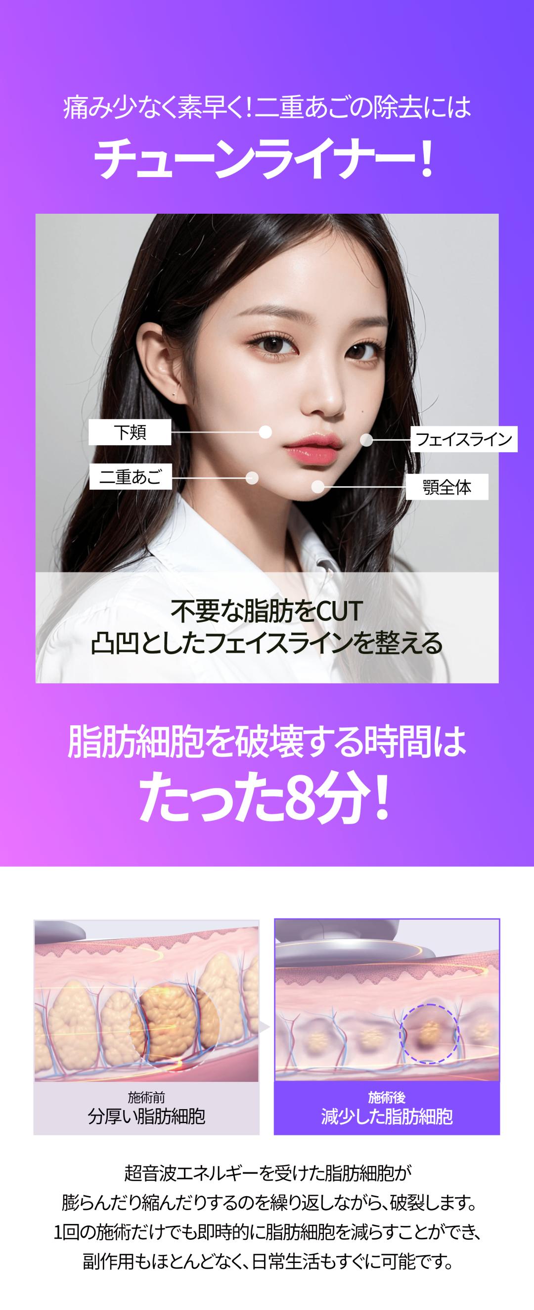 Nâng cơ tự nhiên, cải thiện nọng cằm với Tune Face & Tune Liner｜Seoul Gangnam stn.・Viện Jfeel Gangnam