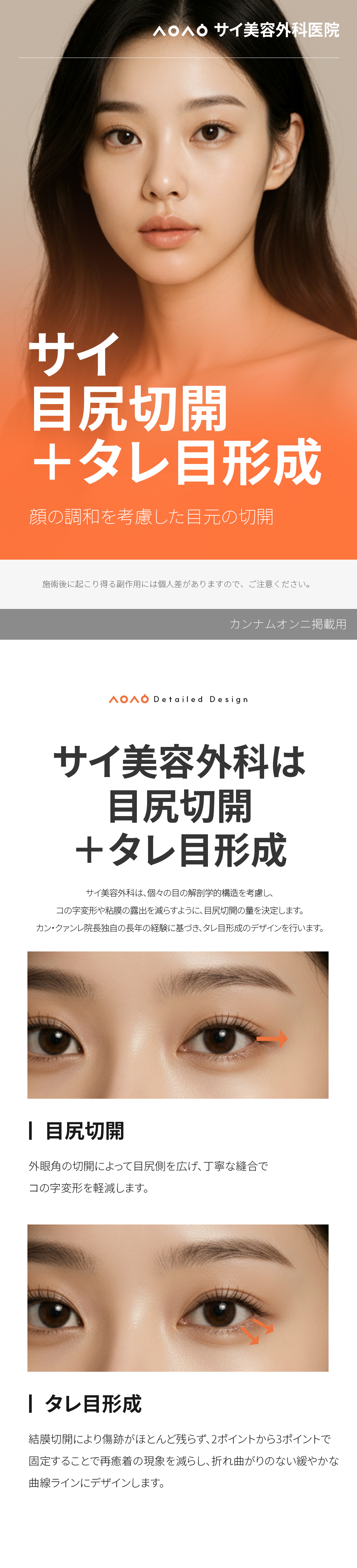 Cắt đuôi mắt + Tạo mắt cụp | Thiết kế tự nhiên bởi bác sĩ chuyên khoa thẩm mỹ | Phòng khám Sai Thẩm mỹ (Seoul Apgujeong)