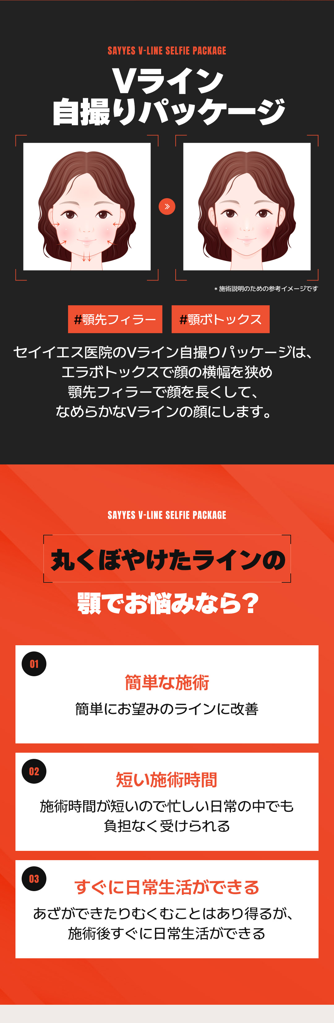 Gói tạo V-line Hàn Quốc｜Filler cằm + Botox hướng đến đường viền sắc nét｜Phòng khám Say Yes Gangnam Seoul