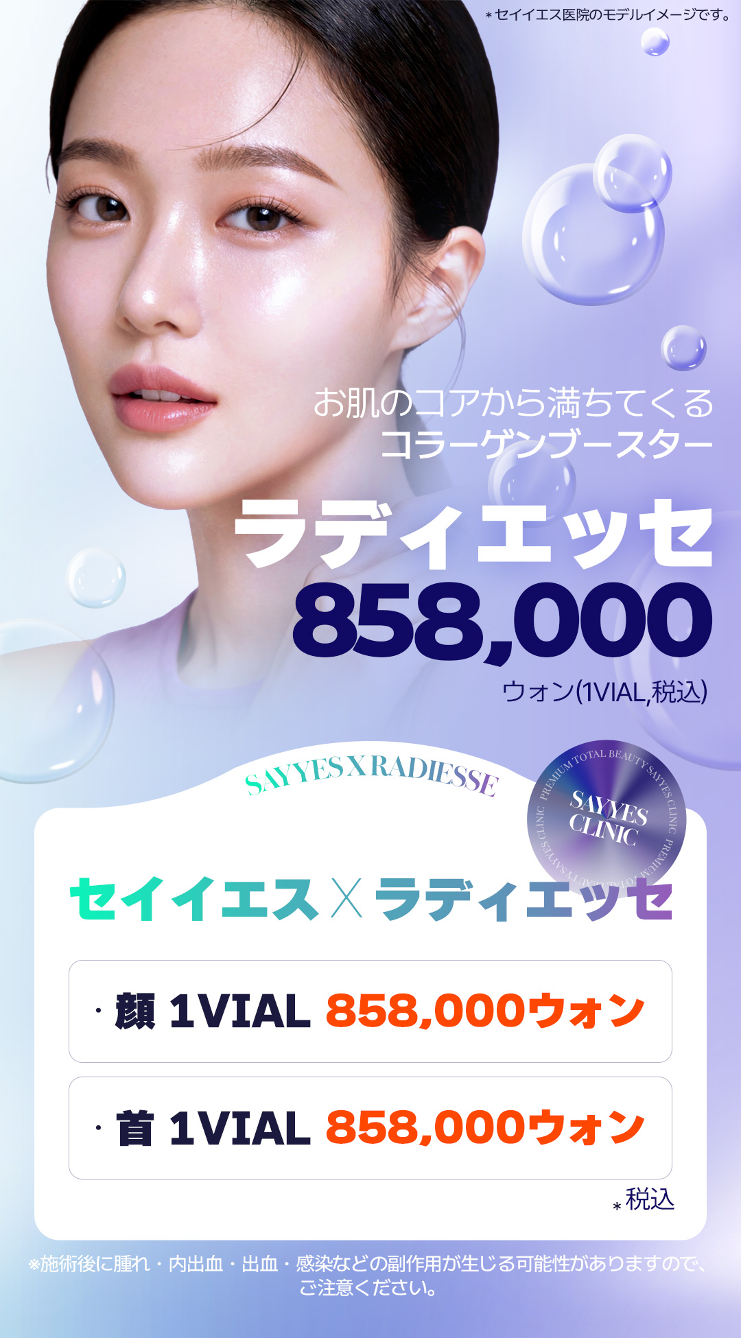 Liệu pháp Radiesse (Collagen Booster) | Phòng khám Seyyes gần ga Sinnonhyeon, Seoul