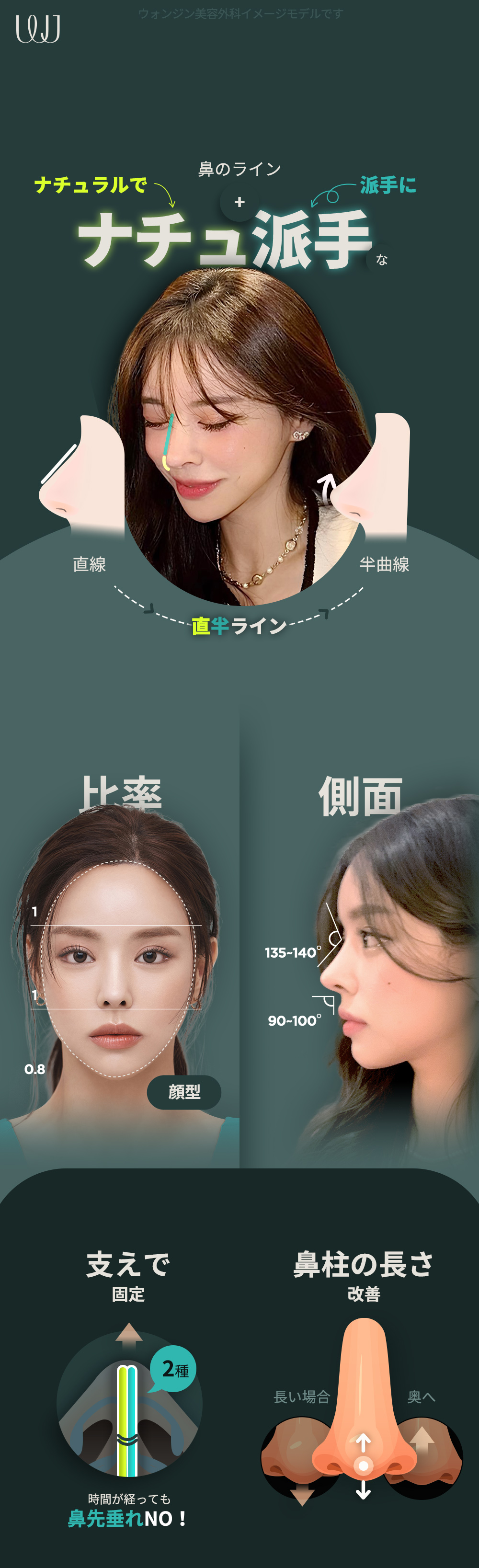 Nâng mũi Nachu Rực Rỡ | Nâng mũi kết hợp tự nhiên và rực rỡ | WJ Wonjin Phẫu thuật Thẩm mỹ・cách ga Gangnam 3 phút đi bộ