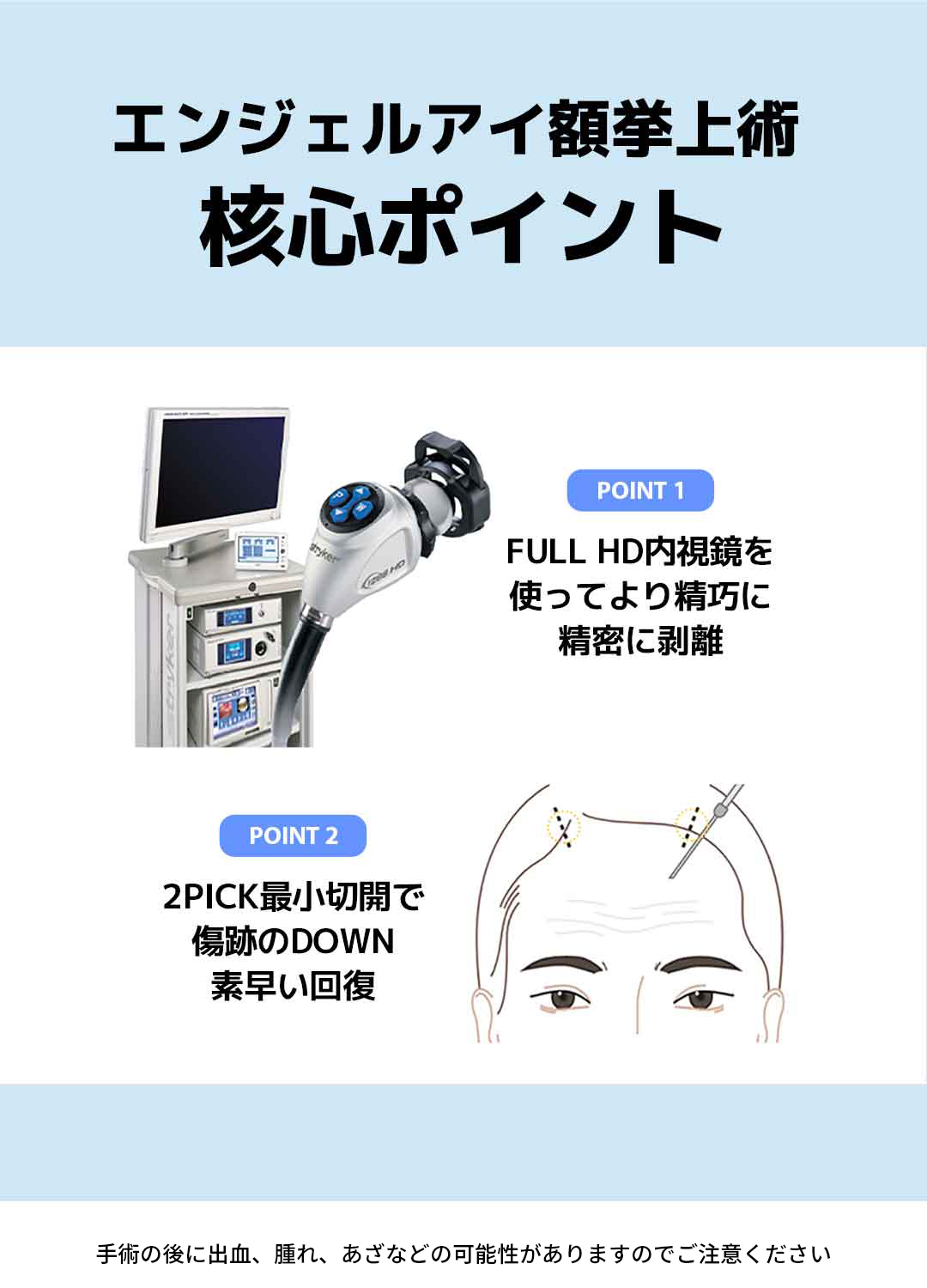 Nâng trán Angel Eye｜Hướng đến cải thiện chảy xệ mí mắt, sụp mày｜Viện thẩm mỹ WJ Wonjin (ga Gangnam)